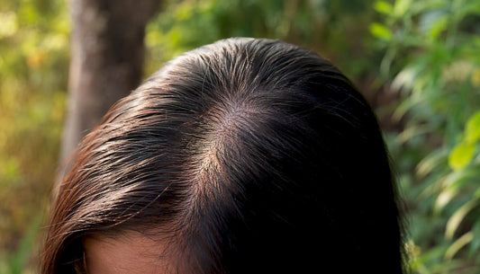 Close-up hair follicles and scalp