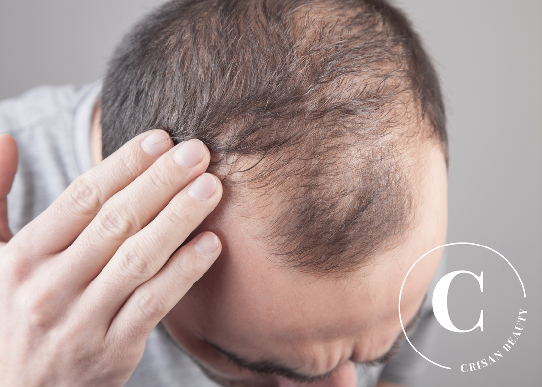 23 tips to help you prevent hair loss