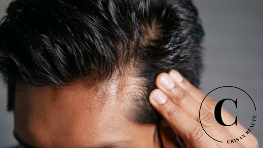 18 Best Hair Loss Treatments for Men in 2022